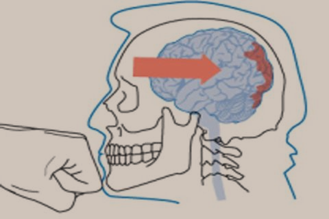  2.png